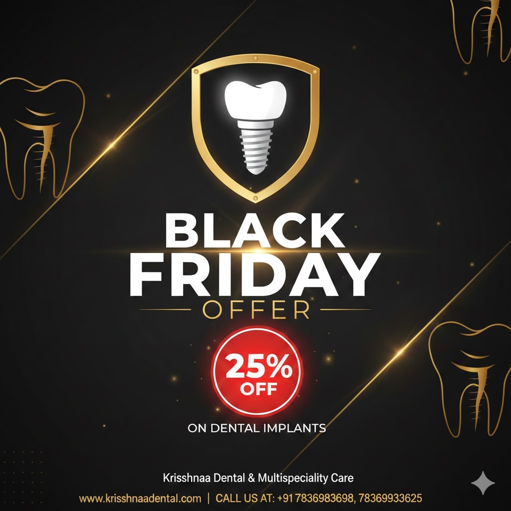 25% OFF Dental Implants (Black Friday Special)